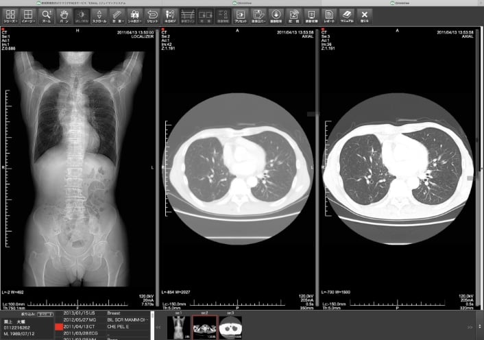 CT画像表示例