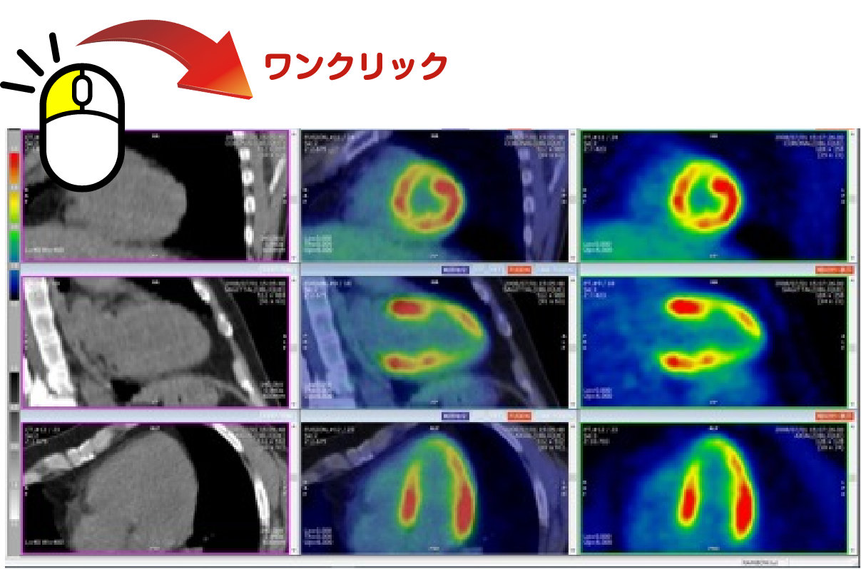 心臓三軸再構成画像